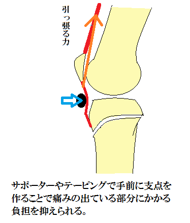 オスグット病サポーターの効果